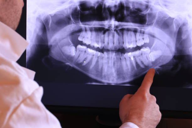 Best Orthodontic Emergency Dentist in Angwin, CA